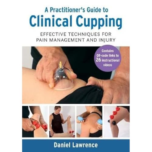 Book cover showing clinical cupping therapy on a patient’s back.
