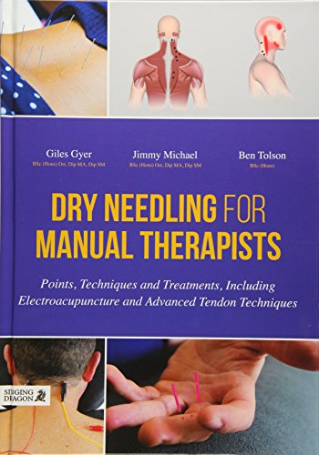 Book cover illustrating dry needling techniques with anatomical diagrams and images.