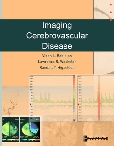 Book cover with medical imaging, text “Cerebrovascular Disease”, and author names.