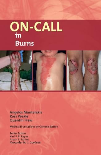 Book cover showing images of severe burns on human skin.