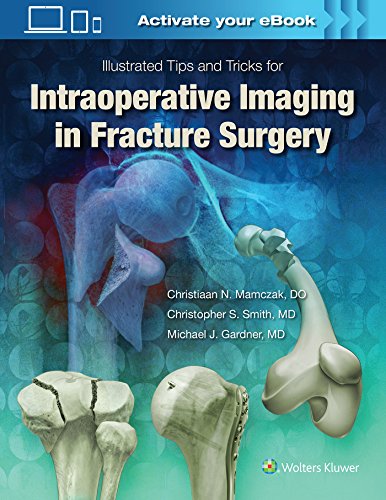 Book cover: “Intraoperative Imaging in Fracture Surgery” with skeletal illustrations.