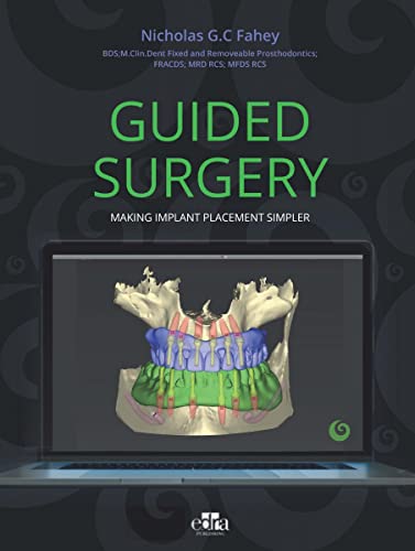 Book cover for "Guided Surgery" displaying a dental implant 3D model.