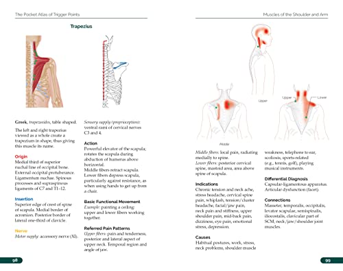 Anatomy chart of the trapezius muscle with trigger point locations highlighted in red.