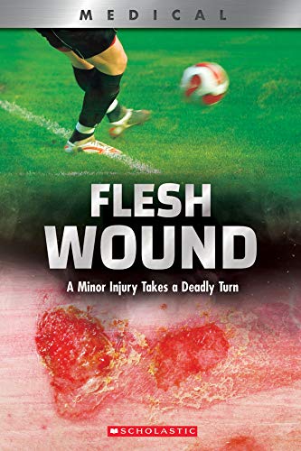 Book cover: "Flesh Wound" depicts a soccer player and a graphic wound.