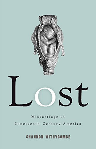 Book cover with vintage anatomical illustration and the title "Lost.