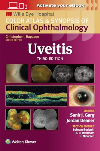 Book cover for "Uveitis," a clinical ophthalmology atlas with eye images.