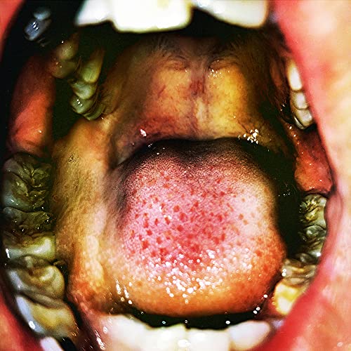 Open mouth showing teeth, tongue, and palate, album cover art.