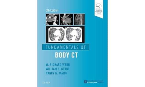 Book cover: āFundamentals of Body CTā with medical scan images.