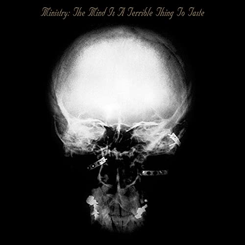 An X-ray image of a human skull on a black background.