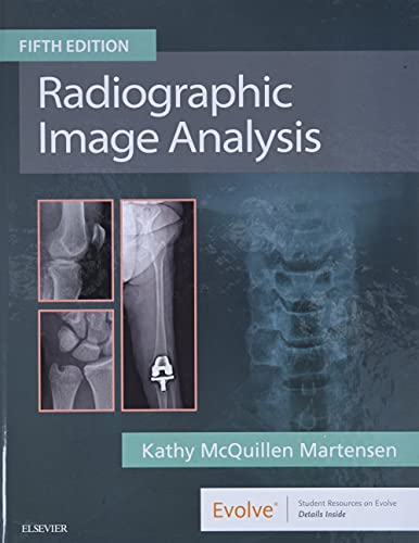 Radiographic Image Analysis, 5e