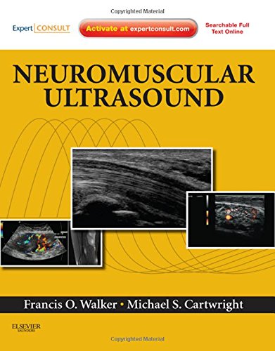 Neuromuscular Ultrasound,: Expert Consult - Online and Print