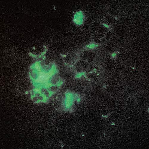 Abstract green glowing shapes against a dark, speckled background.