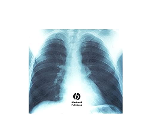 Imaging for Nurses