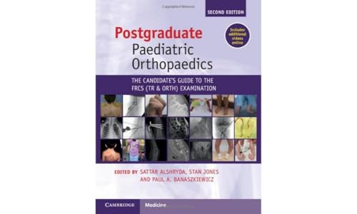Postgraduate Paediatric Orthopaedics : The Candidate's Guide to the FRCS(Tr&Orth) Examination