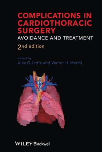 Complications in Cardiothoracic Surgery: Avoidance and Treatment