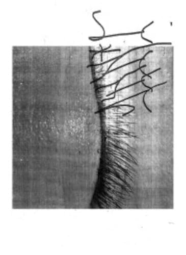 Black and white close-up of an eye with abstract line drawing.