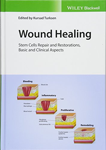 Wound Healing: Stem Cells Repair and Restorations