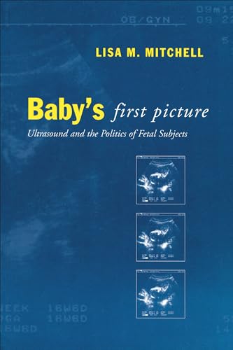 Baby's First Picture : Ultrasound and the Politics of Fetal Subjects