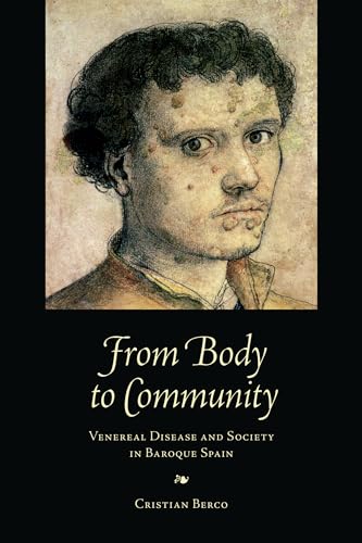 From Body to Community : Venereal Disease and Society in Baroque Spain