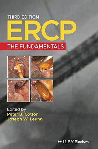Ercp: The Fundamentals