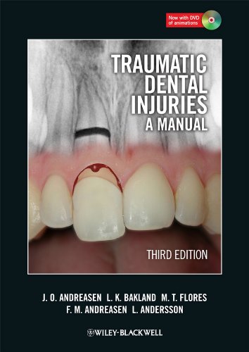 Traumatic Dental Injuries: A Manual