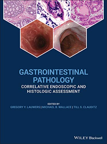 GI Pathology and Endoscopic Biopsy