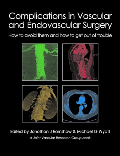 Complications in Vascular & Endovascular Surgery