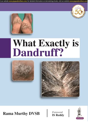 Book cover: "What Exactly is Dandruff?" with close-up scalp images.