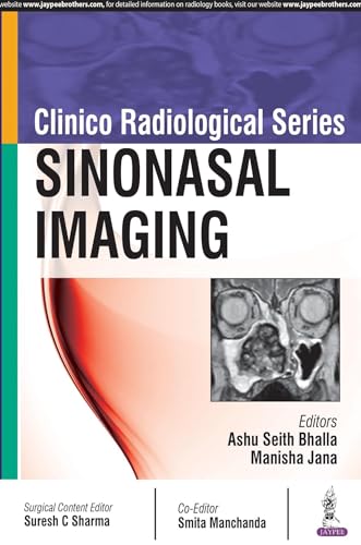 Book cover: "Clinico Radiological Series: Sinonasal Imaging" with a nasal cavity scan.