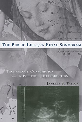 The Public Life of the Fetal Sonogram : Technology, Consumption, and the Politics of Reproduction