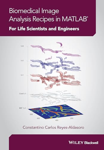 Biomedical Image Analysis Recipes in MATLAB : For Life Scientists and Engineers