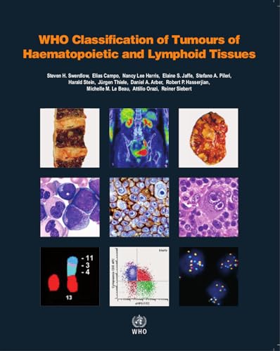 WHO classification of tumours of haematopoietic and lymphoid tissues: Vol. 2