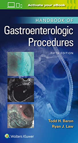 Handbook of Gastroenterologic Procedures (Lippincott Williams and Wilkins Handbook Series): Lippincott Williams & Wilkins Handbook Series