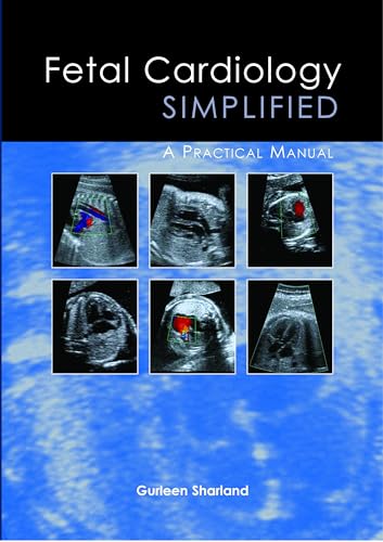 Fetal Cardiology Simplified