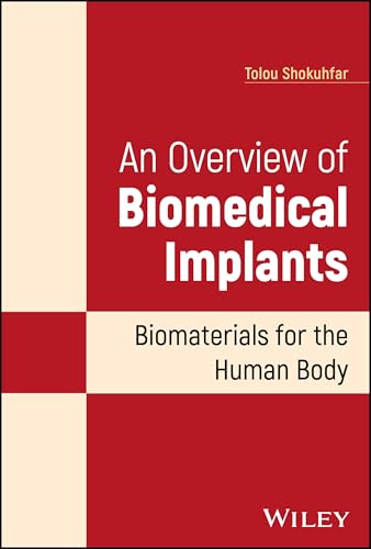 An Overview of Biomedical Implants : Biomaterials for the Human Body
