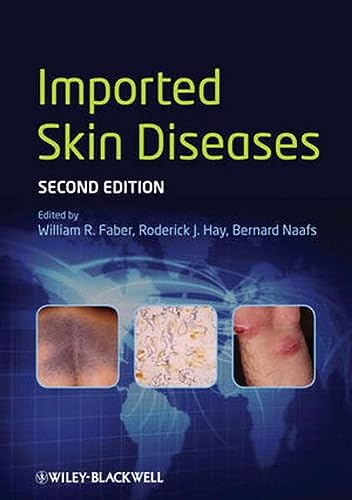 Imported Skin Diseases 2nd Edition