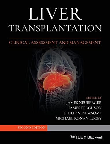 Liver Transplantation : Clinical Assessment and Management