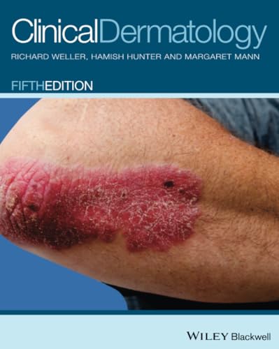 Clinical Dermatology 5E