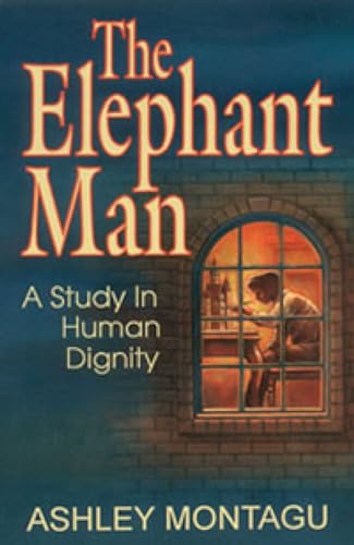 The Elephant Man
