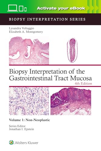 Biopsy Interpretation of the Gastrointestinal Tract Mucosa Volume 1 : Non-Neoplastic: Print + eBook with Multimedia : 1