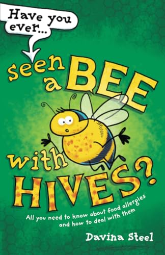 Have You Ever Seen a Bee with Hives? : All you need to know about food allergies and how to deal with them