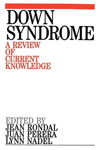 Downs Syndrome: A Review of Current Knowledge
