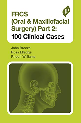 FRCS (Oral &amp; Maxillofacial Surgery) Part 2: 100 Clinical Cases