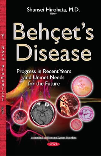 Behçet’s Disease