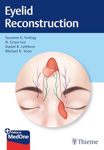 Eyelid Reconstruction