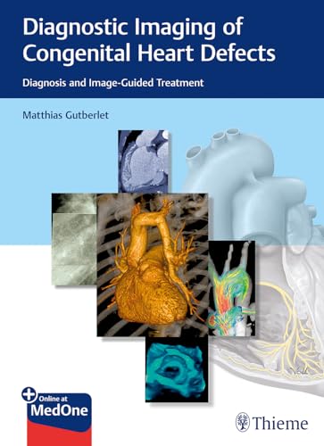 Diagnostic Imaging of Congenital Heart Defects: Diagnosis and Image-Guided Treatment