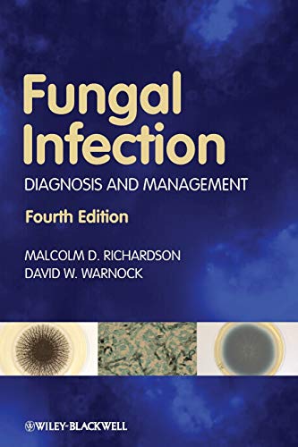 Fungal Infection: Diagnosis and Management