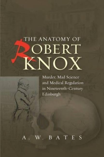 Anatomy of Robert Knox: Murder