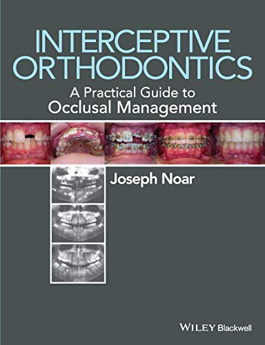 Interceptive Orthodontics - a Practical Guide to  Occlusal Management