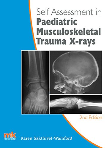 Self-Assessment in Paediatric Musculoskeletal Trauma X-Rays : 4